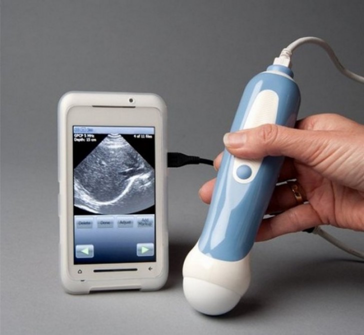 5. A personal portable ultrasound device that plugs into smartphones and tablets.