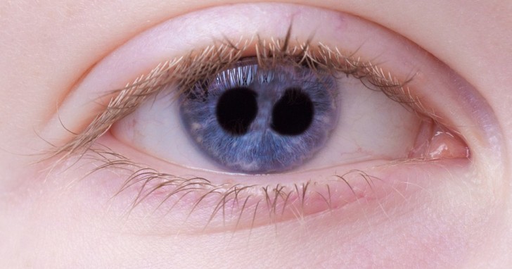 10. Les yeux peuvent avoir plus d'une pupille.