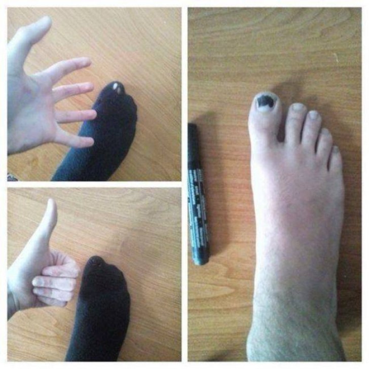 2 - The solution for a black sock with a hole on the big toe? Easy!