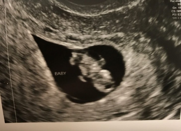 "After 7 years of fertility treatments, today it finally happened!"