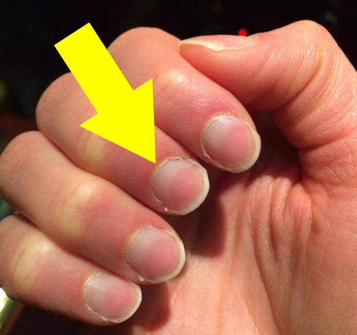 8. Cuticles on fingernails