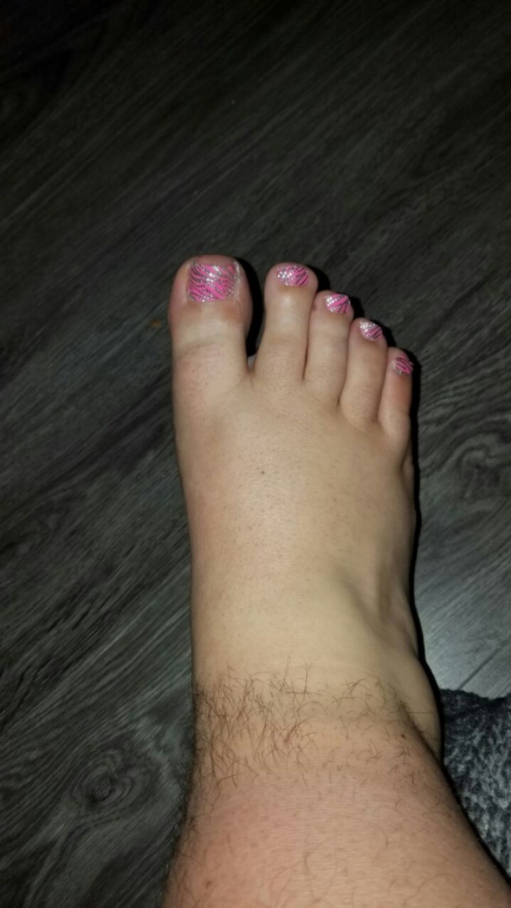 22 - "My husband told me that I would not be able to shave his foot while he was asleep ... well, today he woke up looking like this!"