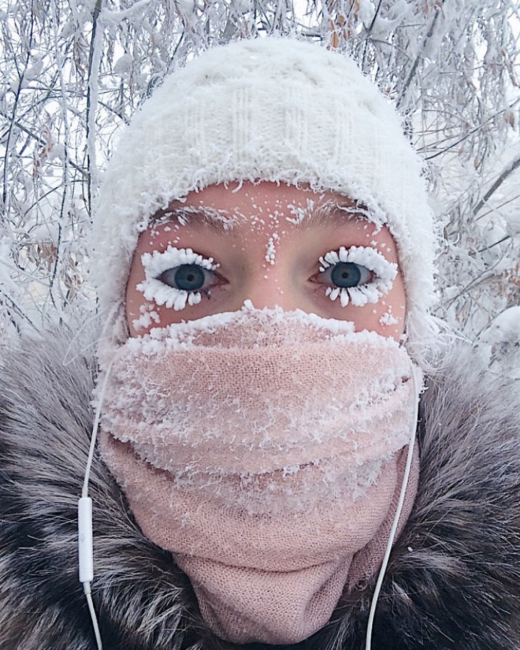 Im Winter ist es so kalt, dass man sich mit vereisten Gesichtshaaren herumplagen muss.