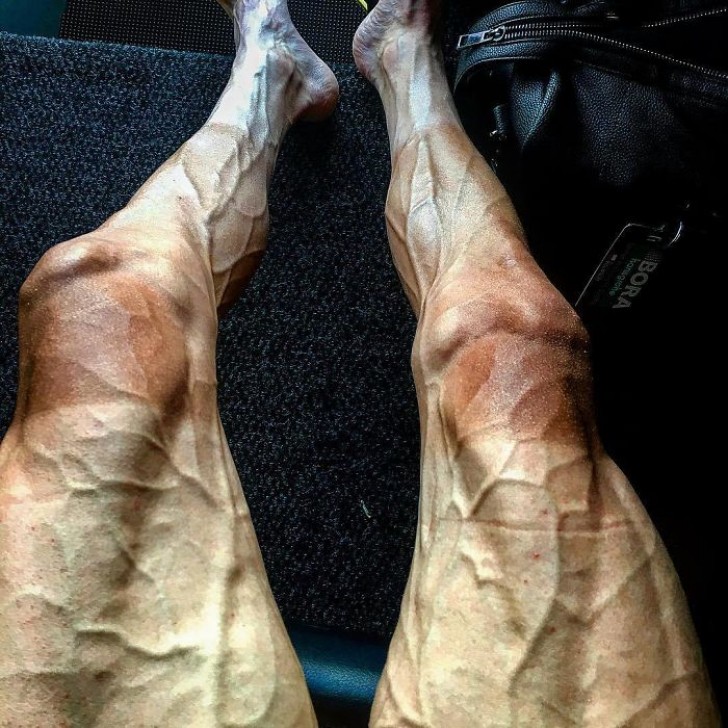 Nachdem er an der Tour de France teilgenommen hat, sehen die Beine eines Radfahrers so aus