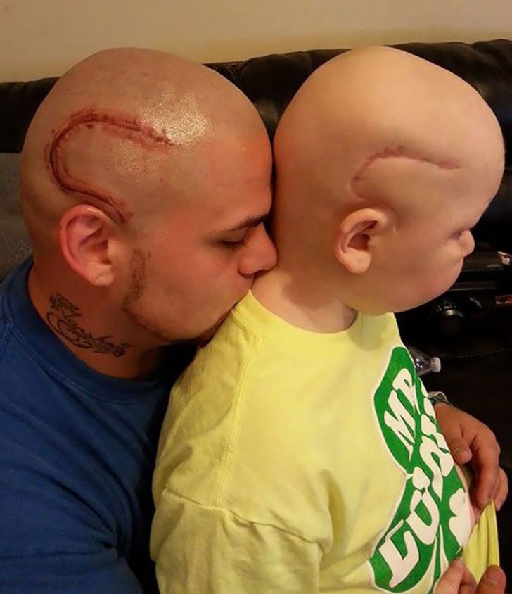 "Per aiutare mio figlio a superare l'orrore di un tumore al cervello".