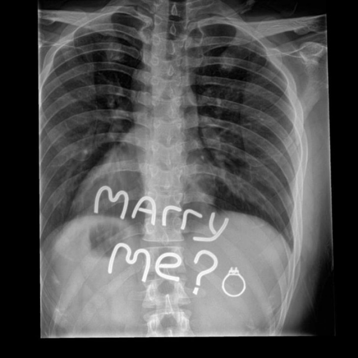 Een röntgenfoto aanpassen om een huwelijksaanzoek mee te doen... Dat bedenkt niet iedereen!