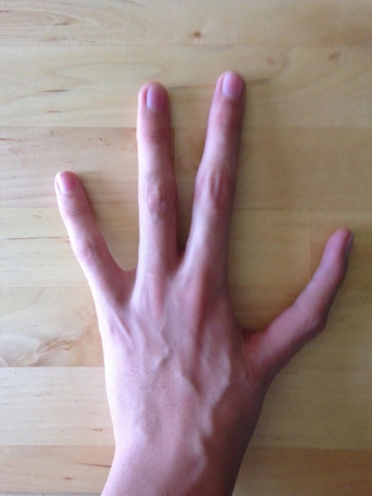 "Meine linke Hand hat 4 Finger anstatt 5 und Anstelle eines Daumens ist ein Zeigefinger".