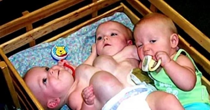 They were born as triplets but two of them are Siamese twins! Looking at them 15 years later is a joy for the eyes! - 1