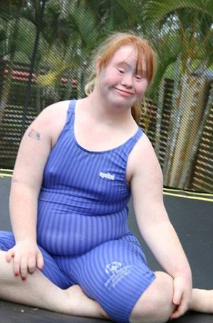 Like many others with Down Syndrome, Madeline grew up with weight problems.