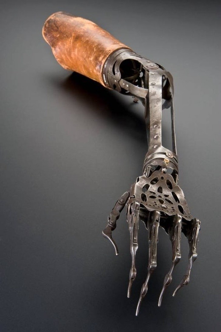 An ancient example of prosthetics.