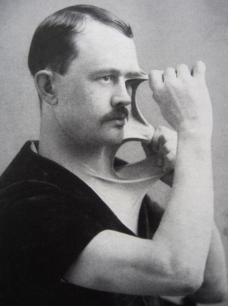 Felix Wehrle, bekannt für seine extrem elastische Haut, etwa 1900.