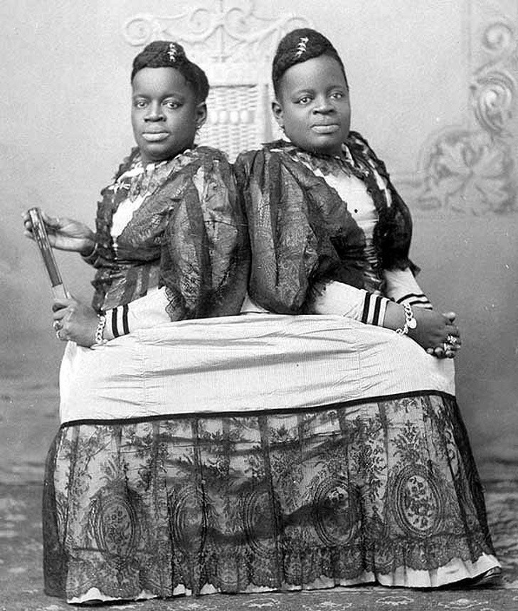 12. Millie et Christine McKoy, "Le rossignol à deux têtes", vers 1860.