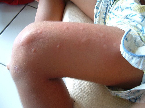 10. Repellente per insetti.