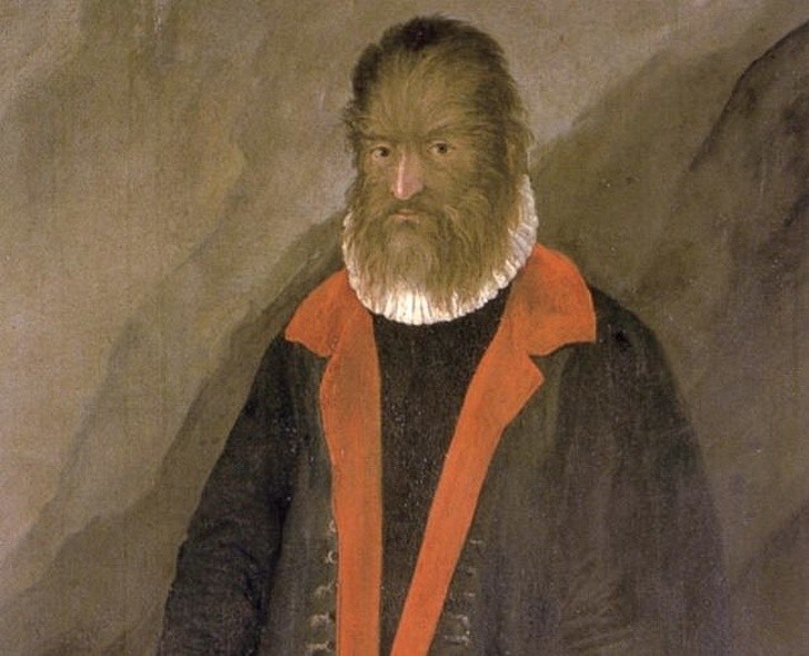 7. Petrus Gonsalvus, l'uomo di legno.