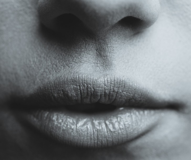 4. Trockene oder rissige Lippen