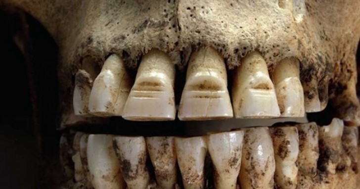 2. Kerben an den Zähnen, um die Fähigkeiten des Kriegers zu demonstrieren
