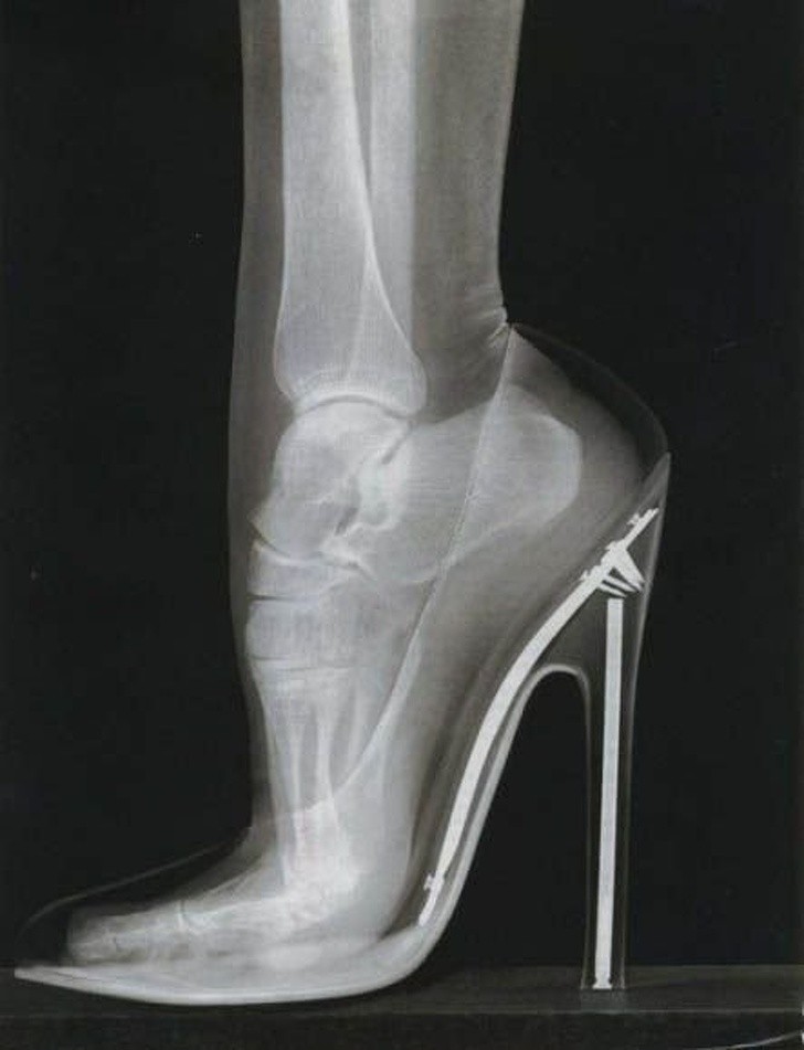 3. Il piede di una donna su dei tacchi molto alti