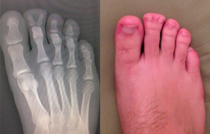 9. Radiografia bizzarra di un piede ancor più bizzarro