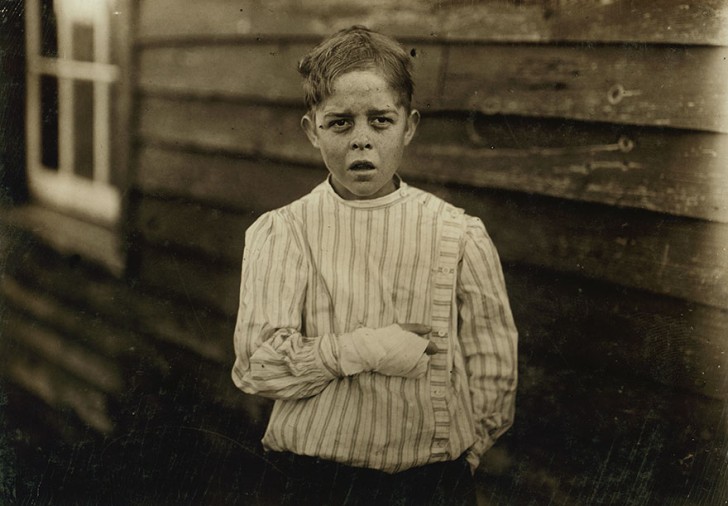 6. Une main du petit Giles Edmund Newsom a été piégée dans les machines d'une industrie textile ; il a dit au médecin qu'il avait 11 ans.