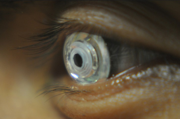 17. Des lentilles de contact qui peuvent tripler la netteté de votre vue, avec lesquelles vous pouvez voir la surface de la lune !