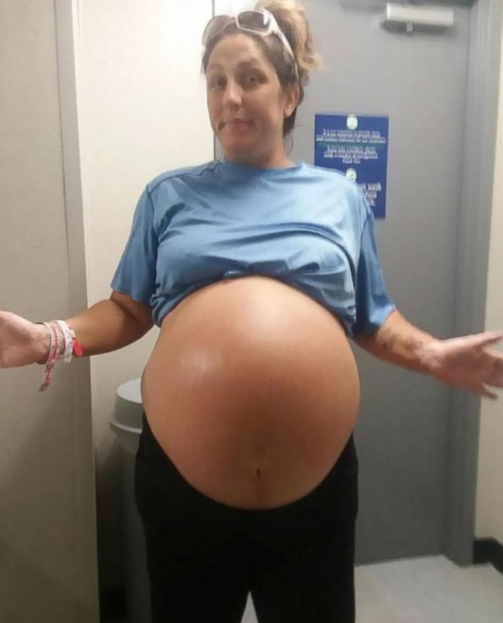 Os médicos que cuidavam e Chrissy não esconderam a surpresa quando viram que a bebezinha pesava 6 kg!