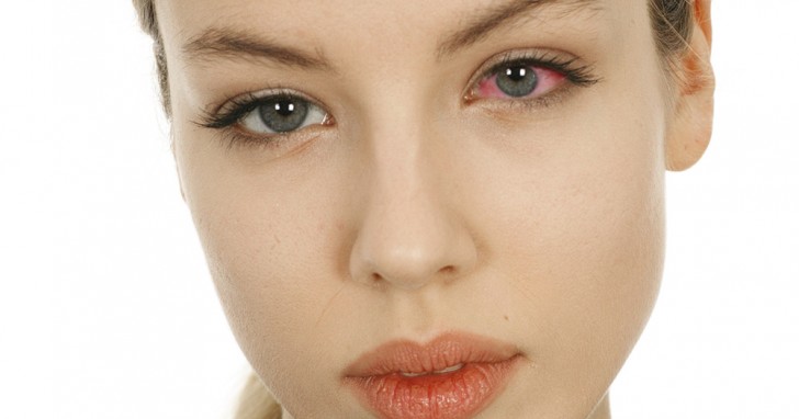 1. Torra ögon eller överdriven produktion av tårvätska