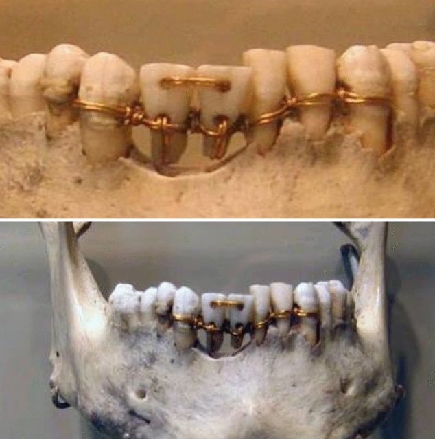 5. Zahnärzte vor vielen Jahrhunderten