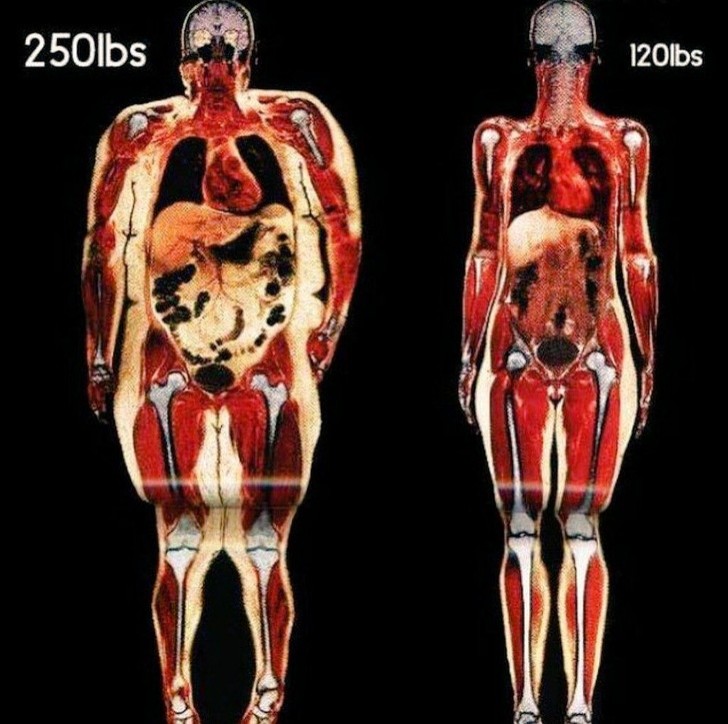 8. Körperscan einer Person von 113 kg und einer Person von 54 kg