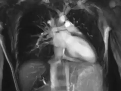 3. Il battito cardiaco registrato dalla risonanza magnetica 