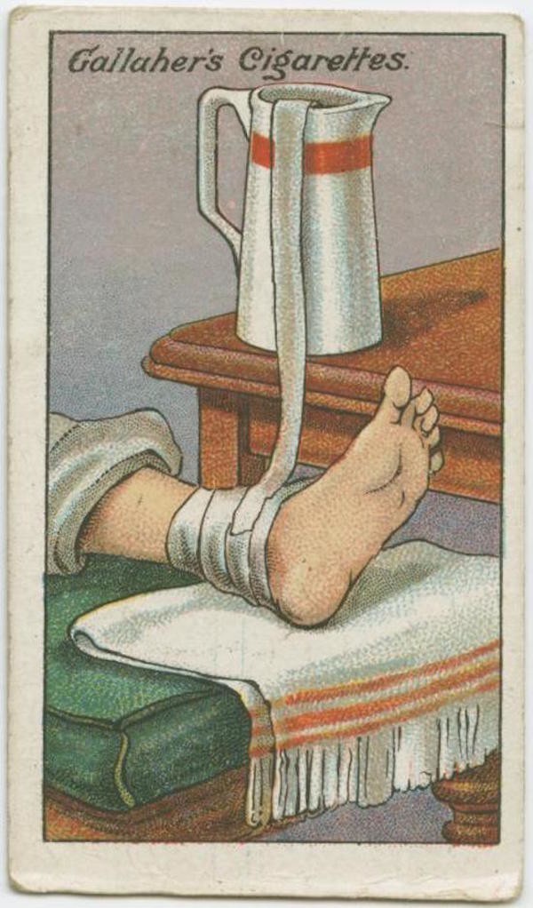 12. In case of an ankle sprain, wrap the ankle in a bandage, and then place one end of the bandage in a jug of cold water, positioned higher up on a table. This will keep the bandages moist and cool.
