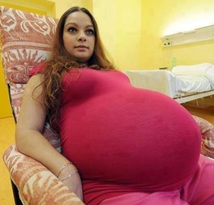 Una mujer es atendida por 40 médicos durantes su parto récord de 5 dulcísimos gemelos - 2