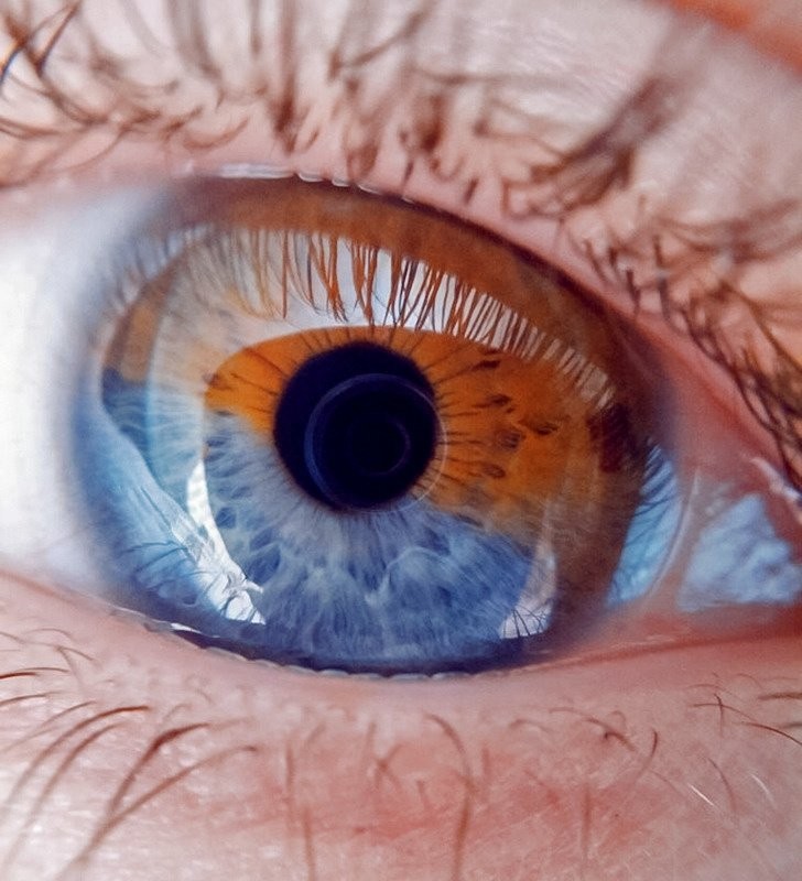 8. Un particolare e affascinante occhio per metà azzurro e metà marrone