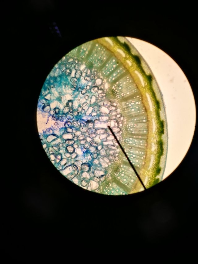 Es sieht aus wie der Schnitt einer Orange, ist aber der Stiel einer Rose unter dem Mikroskop