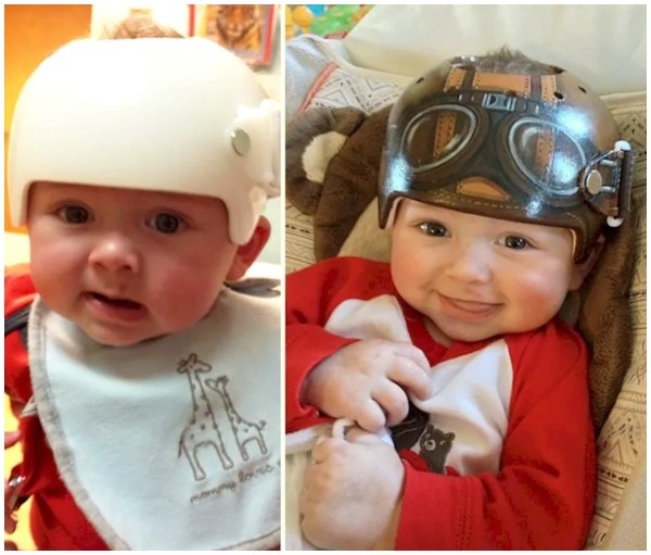Lazardo Art And The Art Of Baby Helmet Painting/Facebook