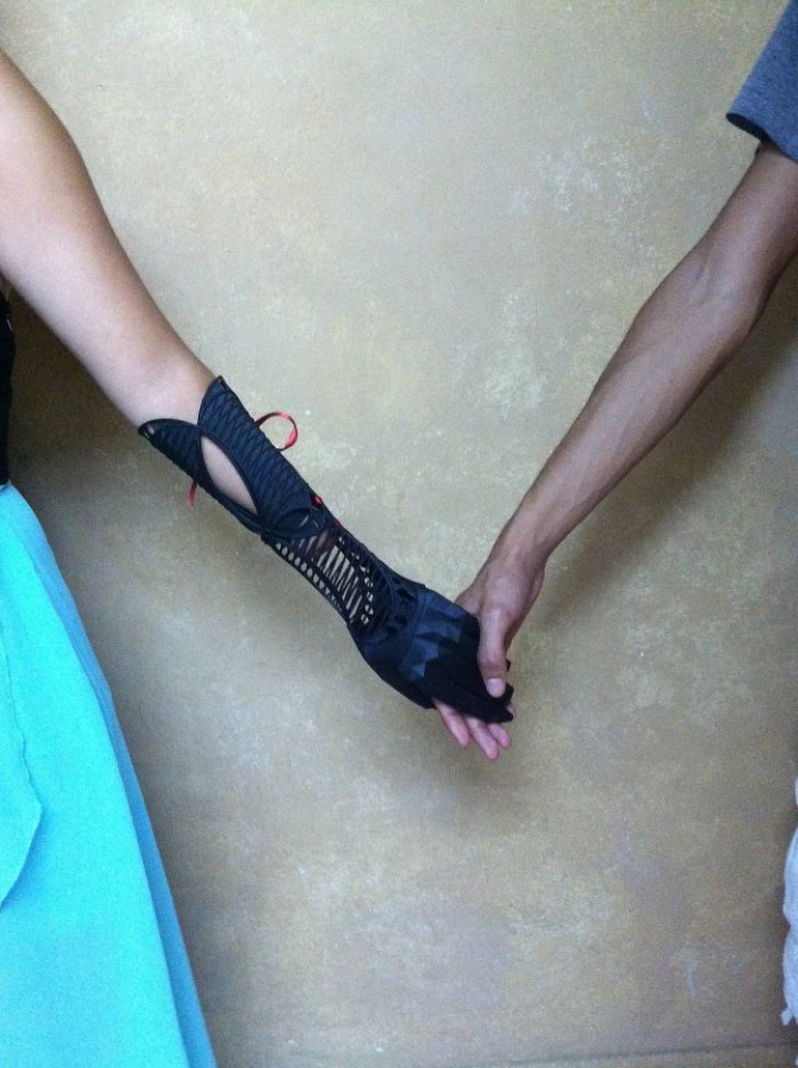 5. Une prothèse du bras... imprimée !