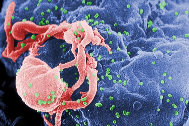 7. Des avancées majeures dans la lutte contre le VIH