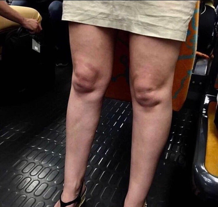 Sieh dir die Knie dieser Frau genau an.... Voldemort, bist du das?