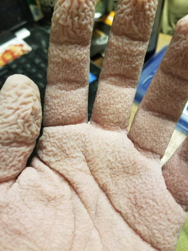 Ecco l'effetto di tenere le mani per troppo tempo sotto l'acqua calda!