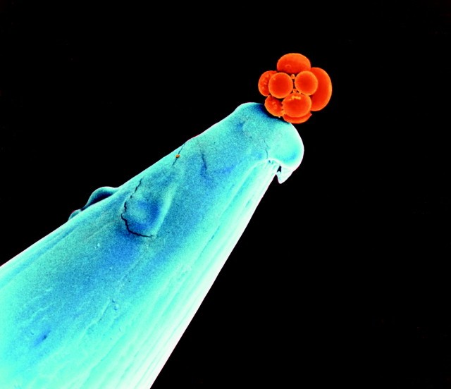 1. Un embryon humain à un stade précoce, sur une pointe d'aiguille.