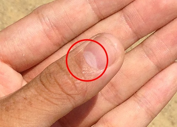 Die weißen Sicheln auf den Nägeln: Was sie sind und was sie über unseren Gesundheitszustand verraten können - 1