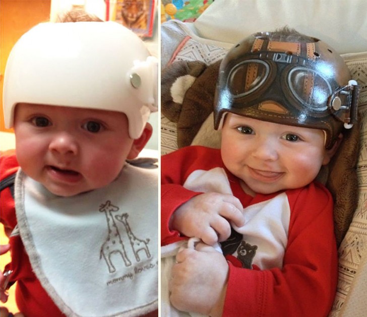 Faire porter un casque correcteur à un enfant peut être très difficile, mais aussi très triste