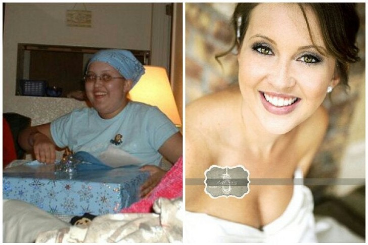 Questa ragazza ha avuto un cancro all'età di 12 anni, e a 22....si è felicemente sposata! Più trasformazione di questa!