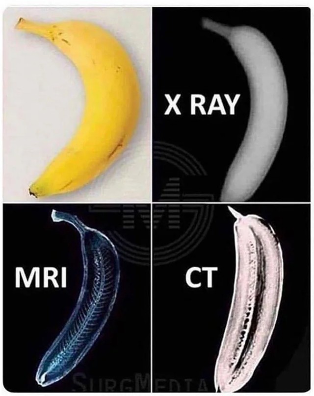 3. Una normalissima banana osservata attraverso diversi tipi di scansione
