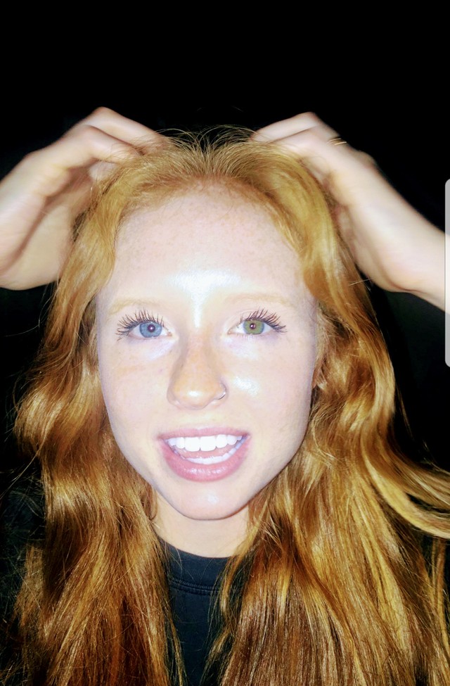 Mia sorella ha i capelli rossi e allo stesso tempo l'eterocromia degli occhi: un capolavoro della genetica!
