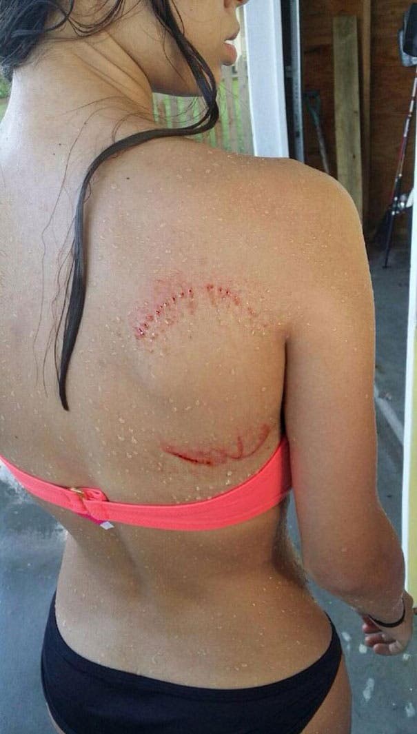 This girl had a terrifying run-in with a shark: she's lucky it barely left a mark!