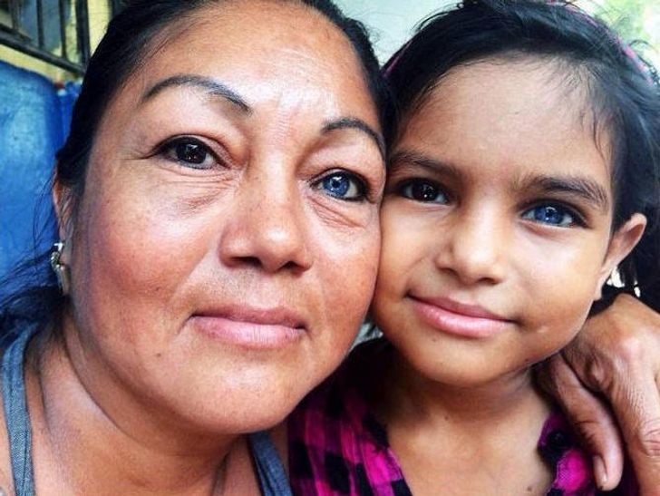 Mamma e figlia hanno entrambe occhi di colore diverso. Tutte e due hanno l'eterocromia degli occhi.