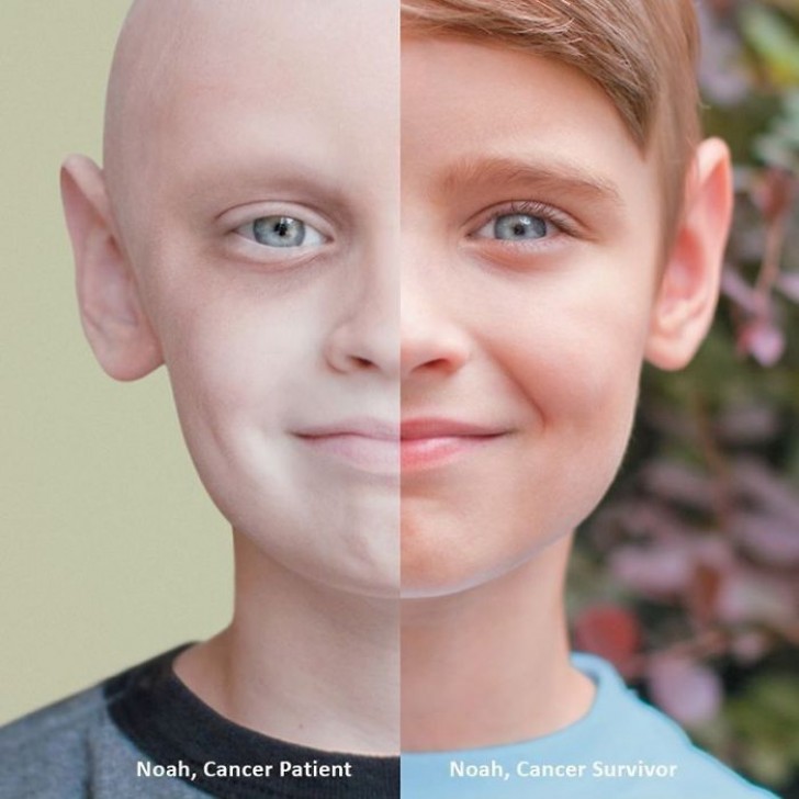 1. Ein Kind, das den Krebs besiegt hat: Die Vergleiche gefallen uns!