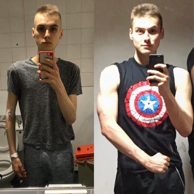 This young man beat anorexia! He became his own superhero!