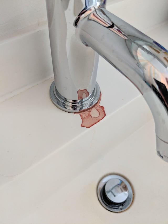 4. "Das Waschbecken in meinem Hotelzimmer blutet..."