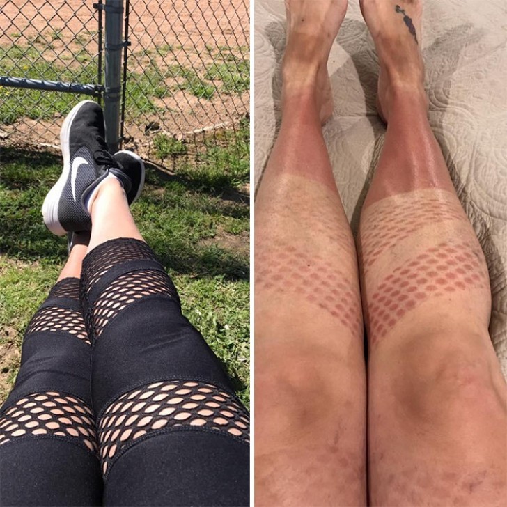 When you decide to sunbathe with some beautiful lacy leggings. A decidedly unusual tan!